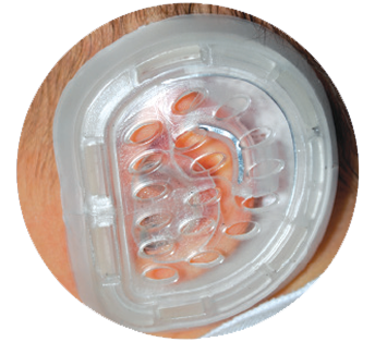 Terapie 4–6 týdnů